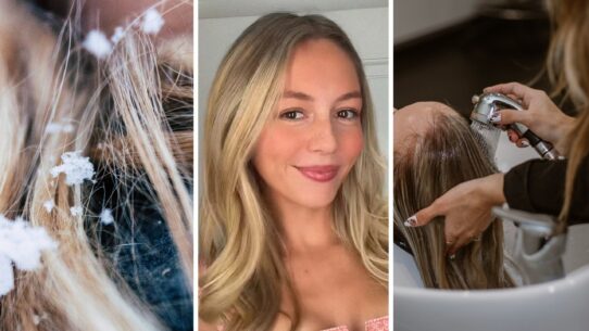 hair dandruff (l) woman shares hair issue (c) woman at the salon (r)